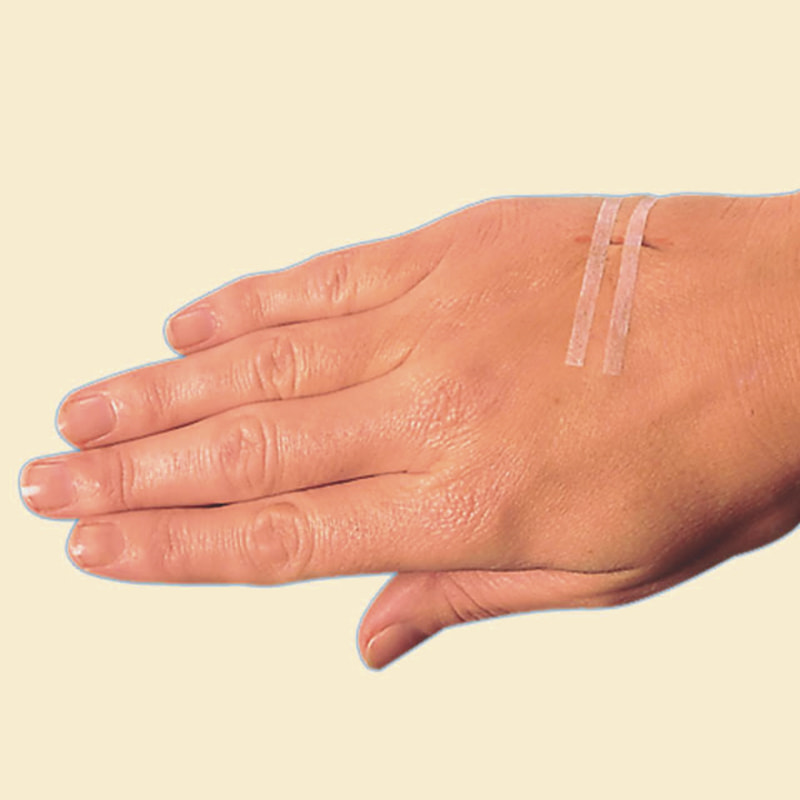 Tira de fechamento de pele